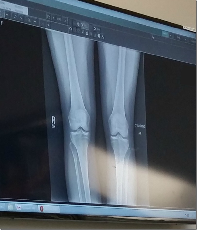 Dat X-ray Doe